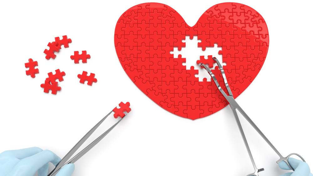 دراسة: جراحة السمنة تتفوق على أدوية إنقاص الوزن في الحد من مخاطر القلب على المدى الطويل featured image