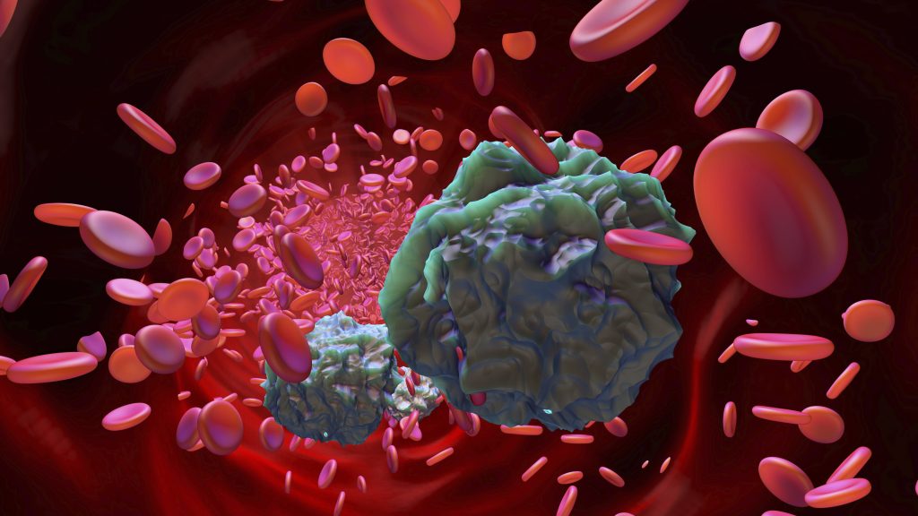Ilustração de células de leucemia