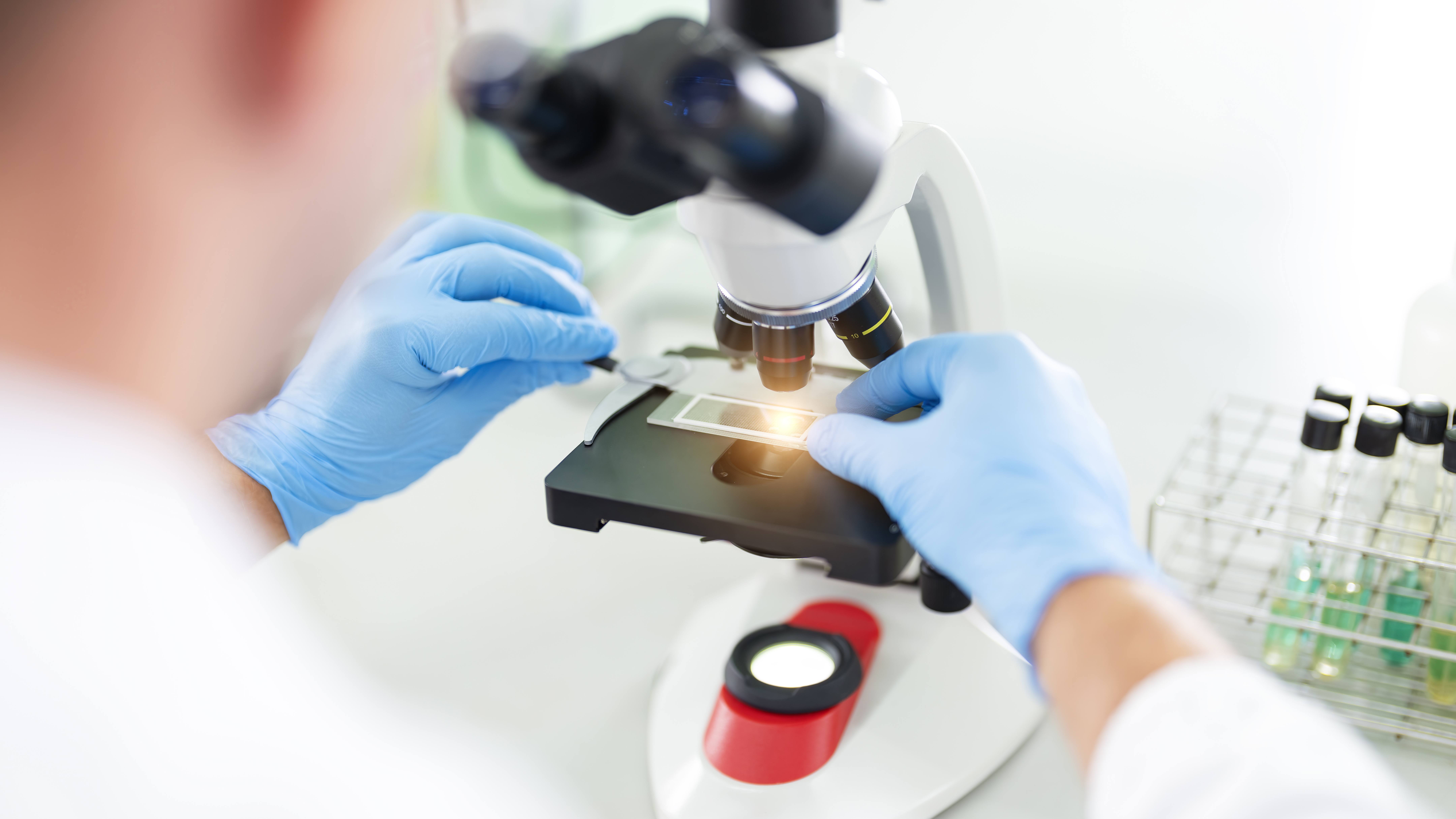 Pesquisadores da Mayo Clinic encontram nova esperança para os casos mais difíceis de mieloma com imunoterapia pronta para uso featured image