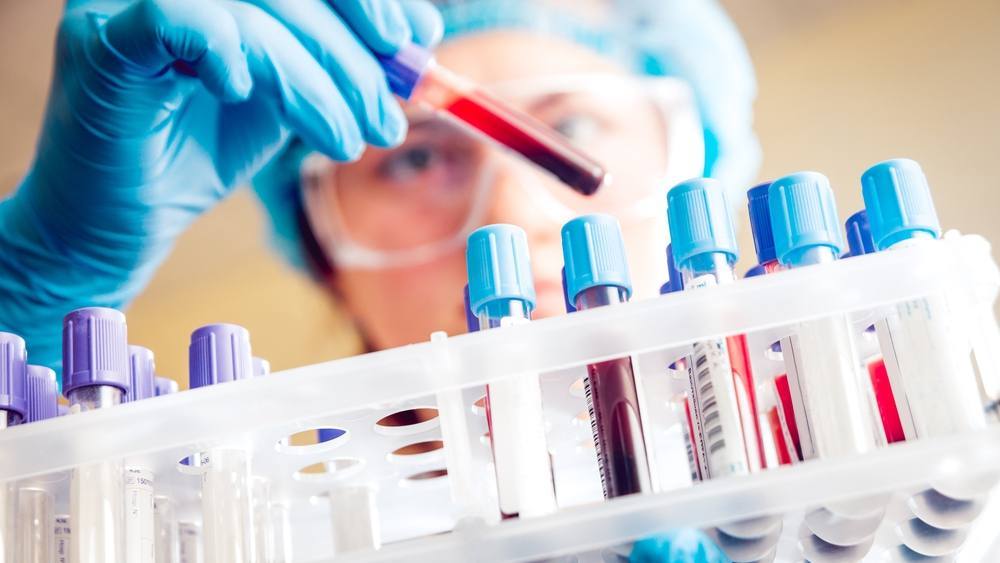 Exame de sangue mostra potencial para detectar câncer testicular quando marcadores padrão falham featured image