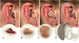 Tipos de audífonos