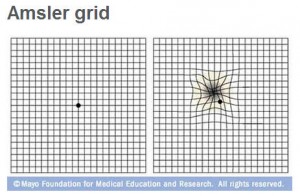 Amsler grid used to check for macular degeneration