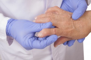 Physician examing patient's hands