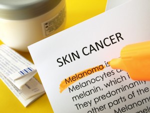 Word cloud definition for skin cancer - melanoma