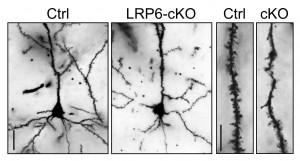 Defective Wnt signaling resulting from loss of LRP6 causes dendritic spines and synapses to degenerate, thereby impairing communications among neurons in the brain.