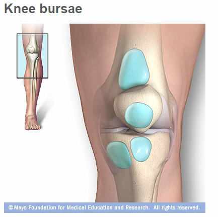 El tratamiento correcto para la bursitis de la rodilla depende de la causa  subyacente - Red de noticias de Mayo Clinic