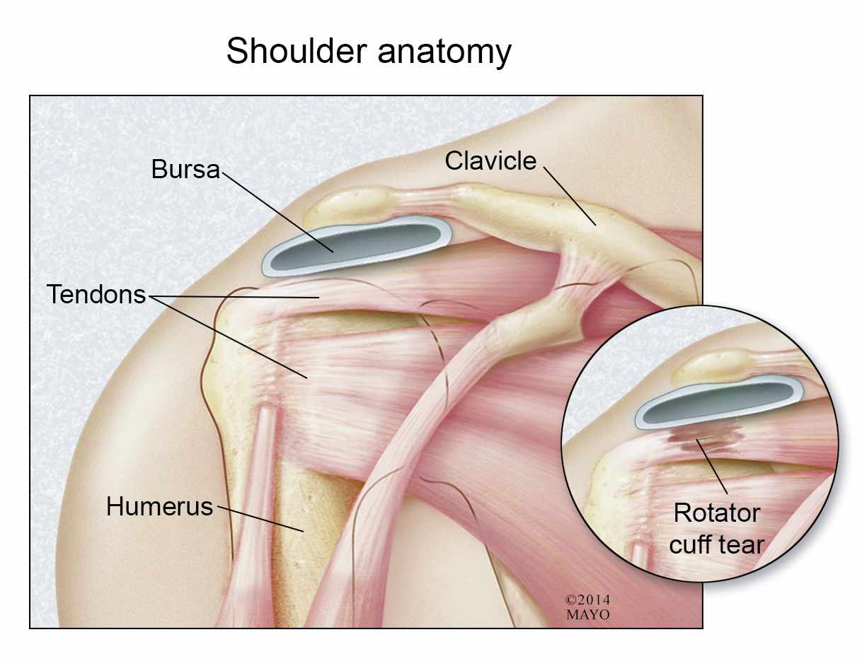 Shoulder Pain, Arthritis, Torn Rotator Cuff