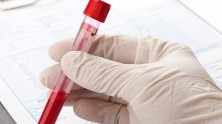 Una mano con un guante de látex sostiene un tubo con muestra de sangre