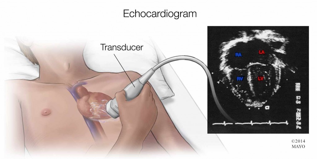 illustration of echocardiogram