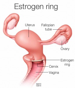 medical illustration, estrogen ring