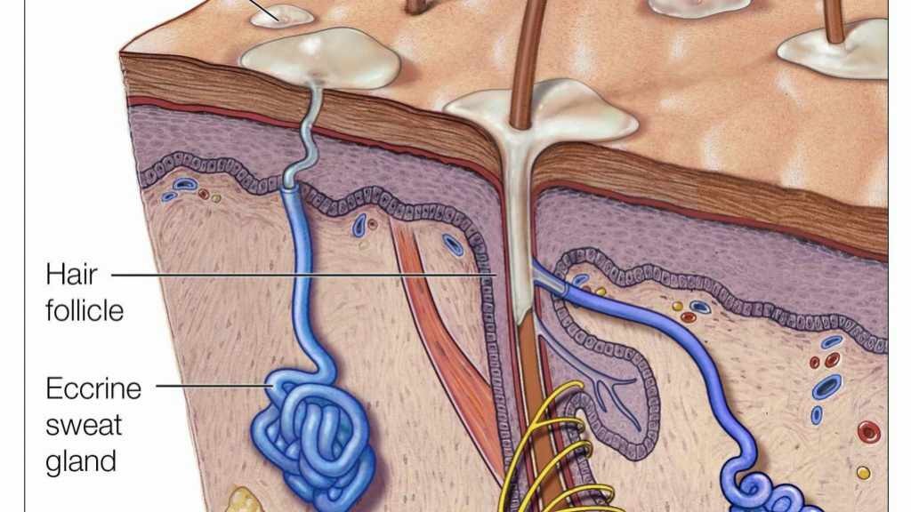 Ilustración médica de los poros sudoríparos, folículo piloso e hiperhidrosis