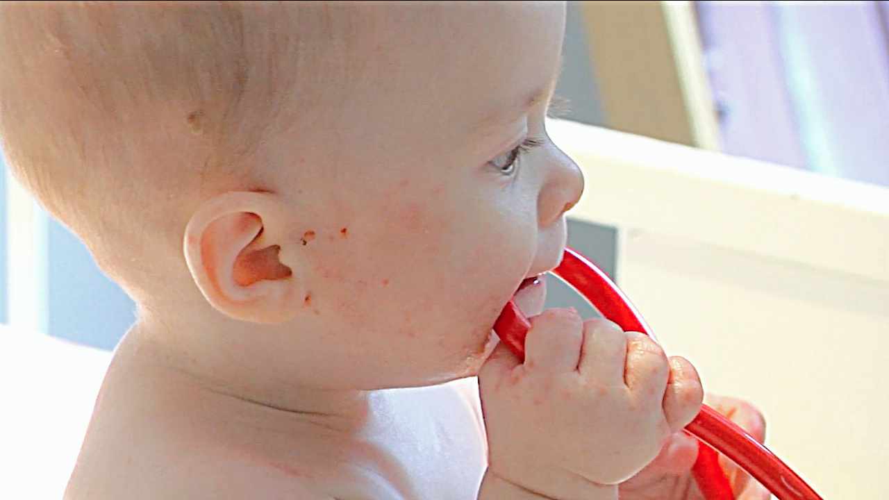 Mayo Clinic Minute Understanding childhood eczema Mayo Clinic News