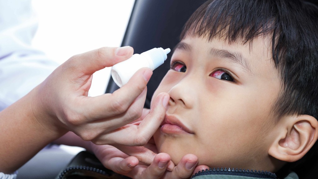 little boy with sore, red eyes getting eye drops
