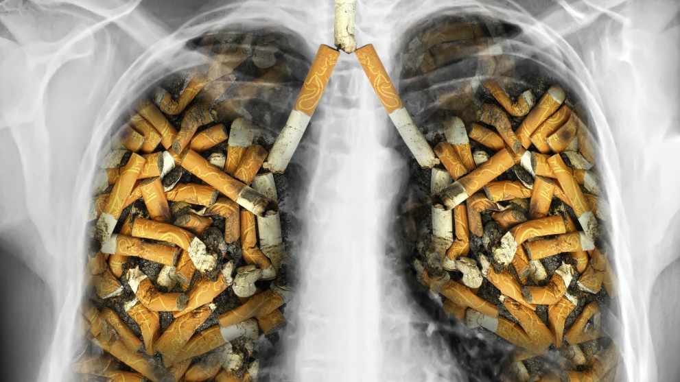 xray of lungs filled with tobacco cigarettes
