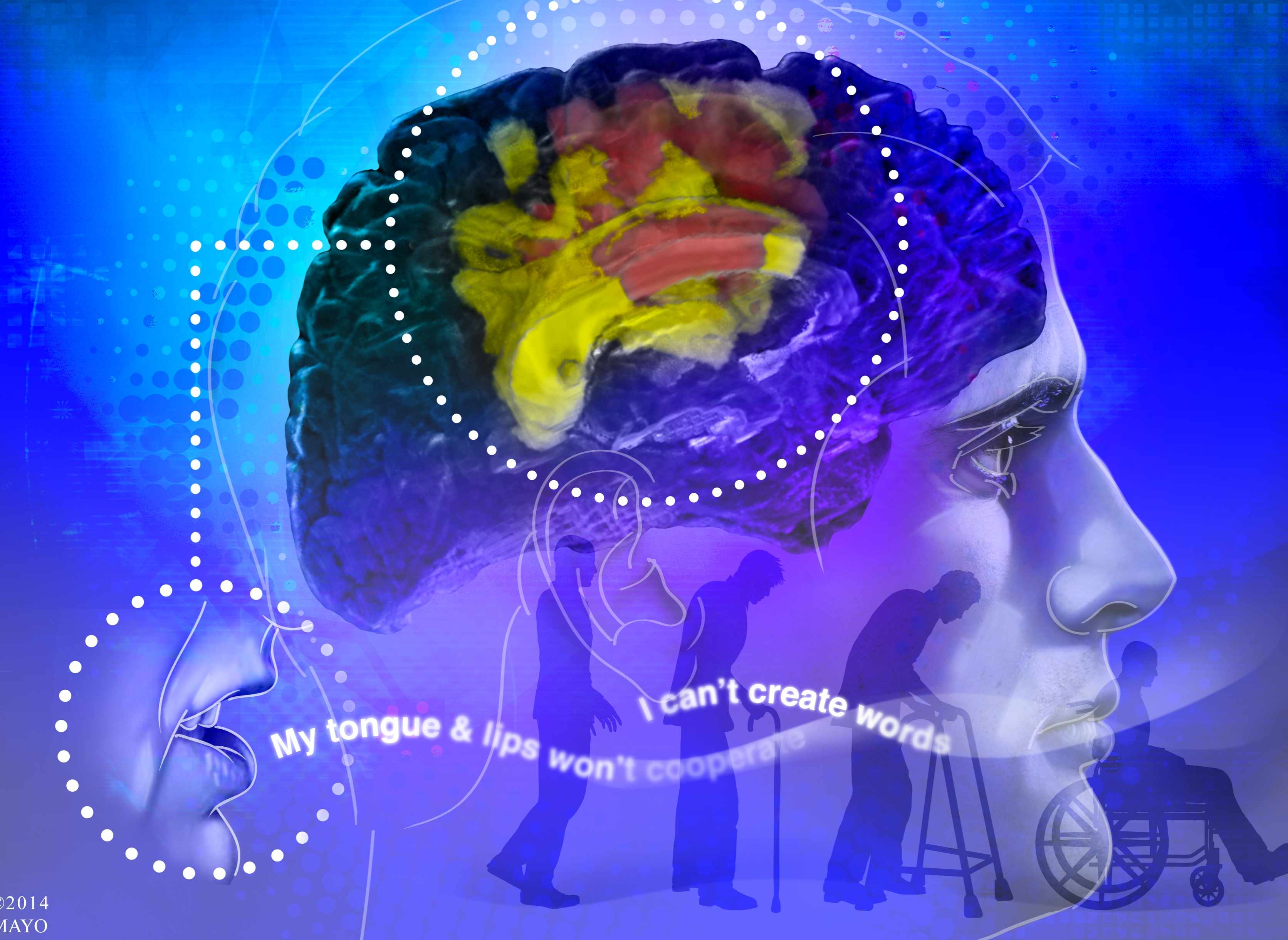Brain illustration wtih aging and decline of man in the background