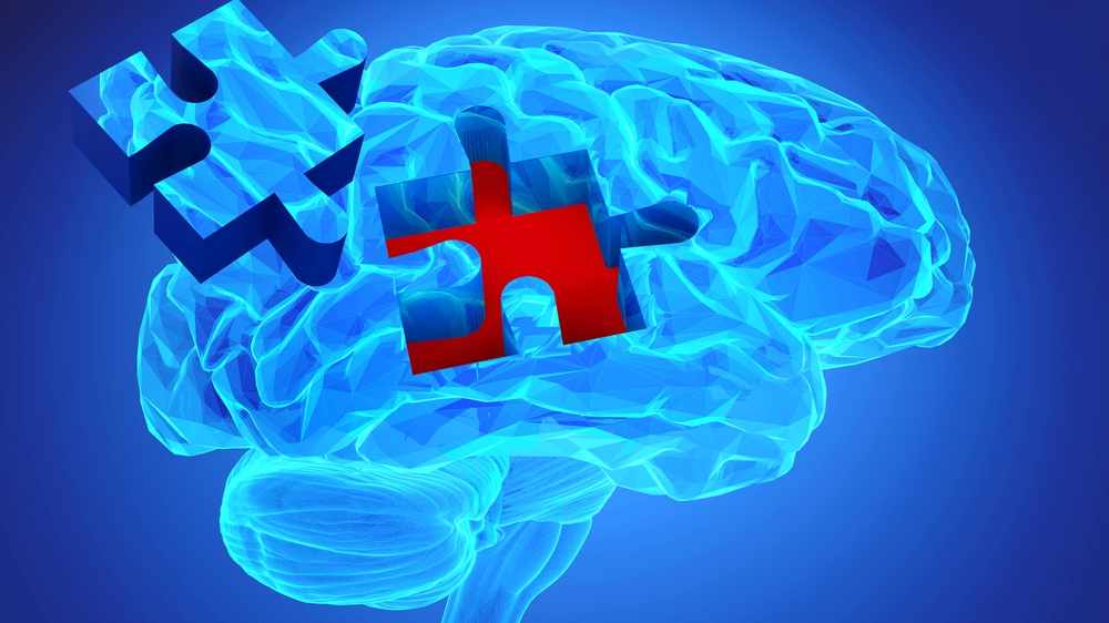 Human brain research and memory loss concept with missing pieces of the puzzle