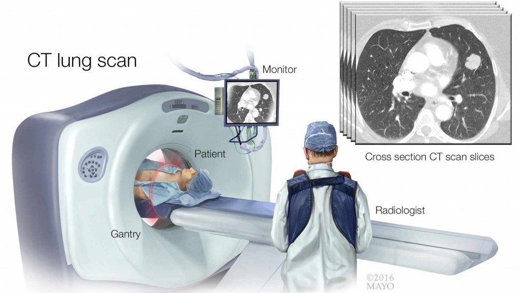 a medical illustration of a CT lung scan