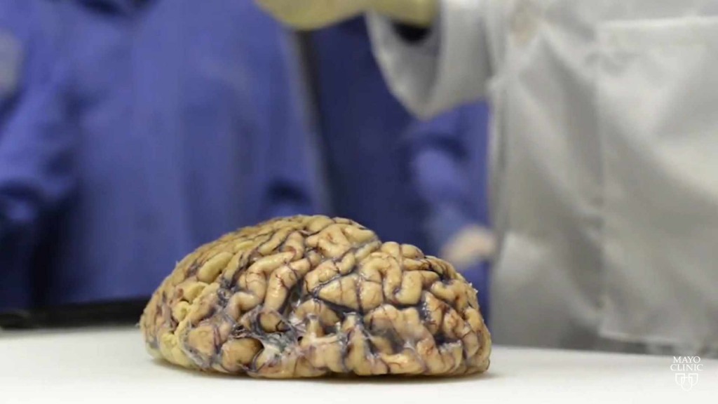 a human brain sitting on a lab table