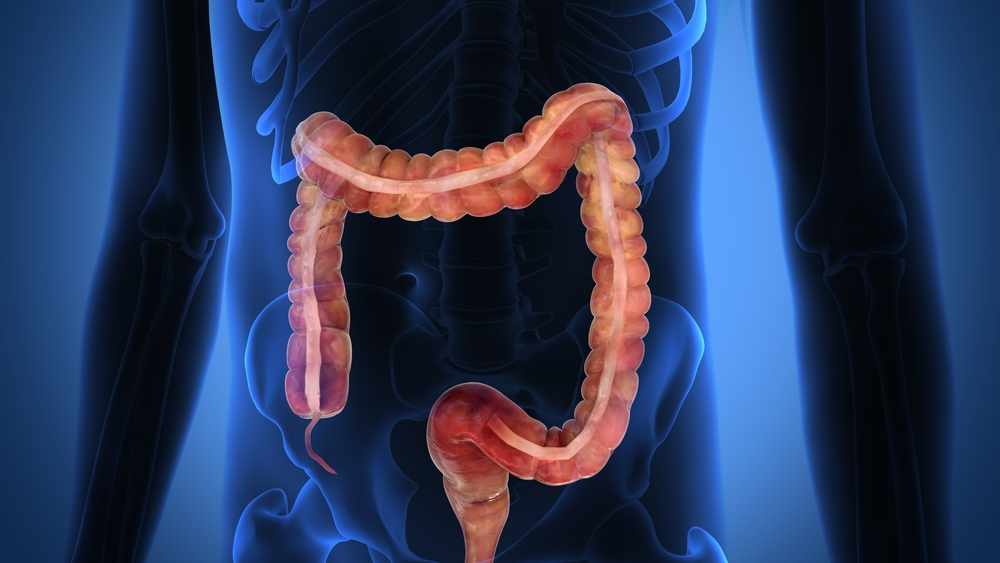 illustration of colon on top of x-ray of body