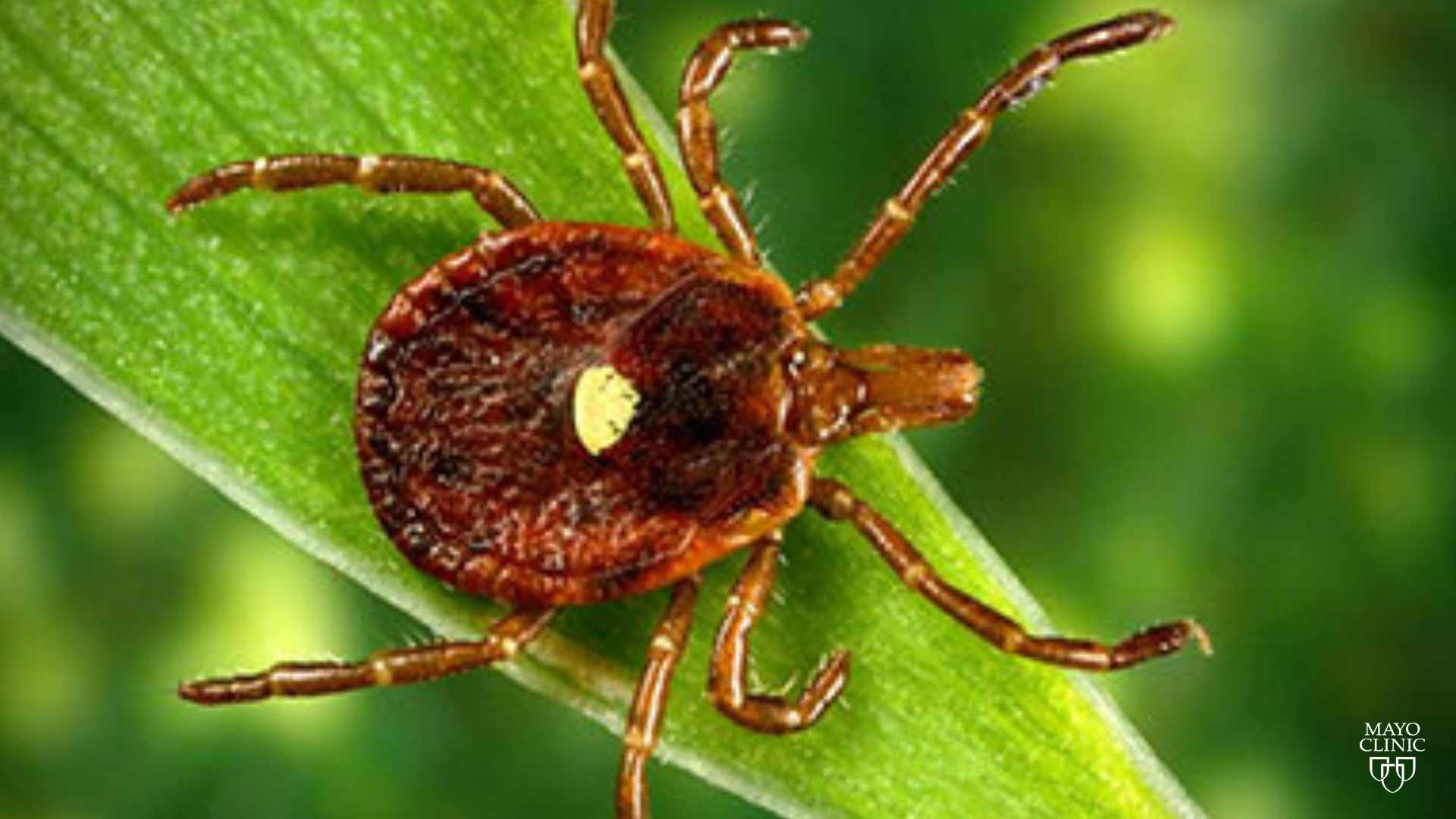 Mayo Clinic Minute Rise In Tick Related Meat Allergy Mayo Clinic