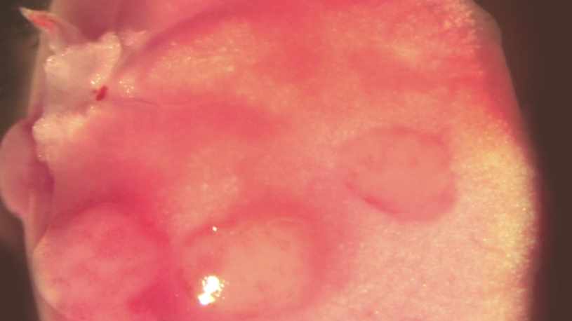 Imagen del pulmón de un ratón con varios tumores