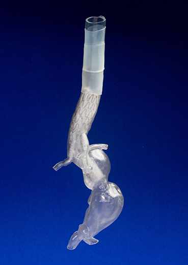 Modelo tridimensional impreso de la aorta de un paciente con aneurisma aórtico complejo