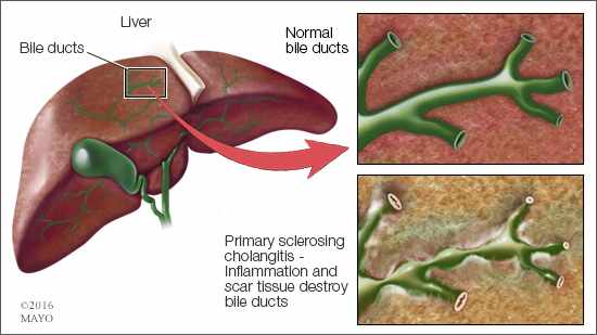 medical illustration of a liver and bile ducts