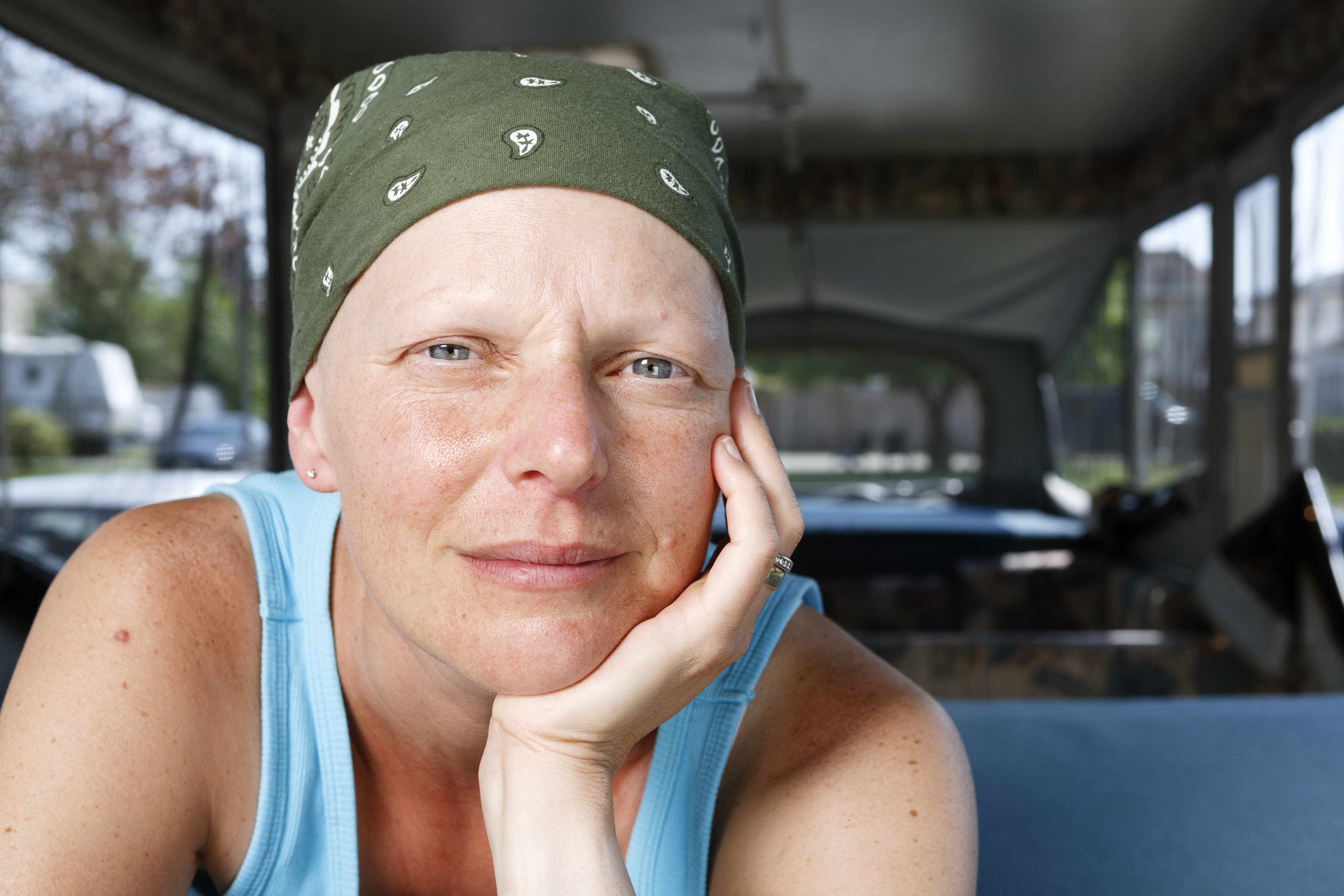 a woman with a headscarf, perhaps due to chemo therapy treatment for cancer, looking pensively into the camera