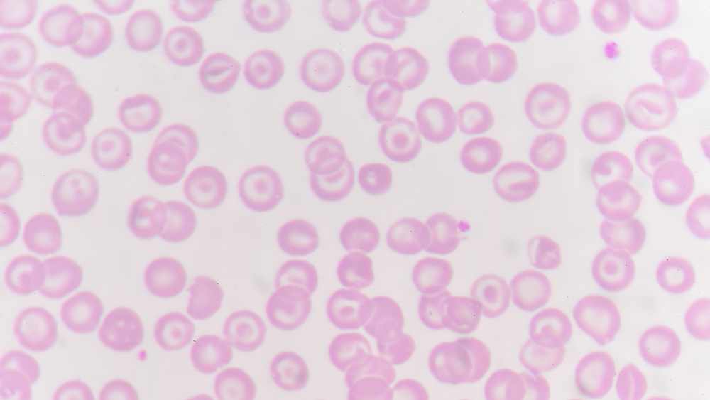 Glóbulos rojos con glóbulos blancos en el trasfondo