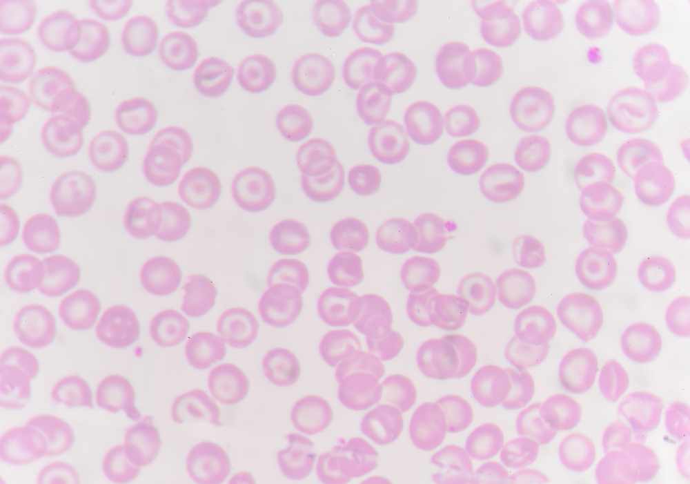 red blood cells with white blood cells background