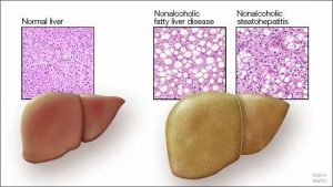 Mayo Clinic researchers identify how fat stores in the liver provide an ...