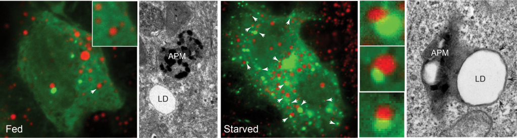 Imágenes microscópicas iluminadas de células hepáticas que crecen en condiciones de buena nutrición (“alimentadas”) o mala nutrición (“bajo inanición”). 