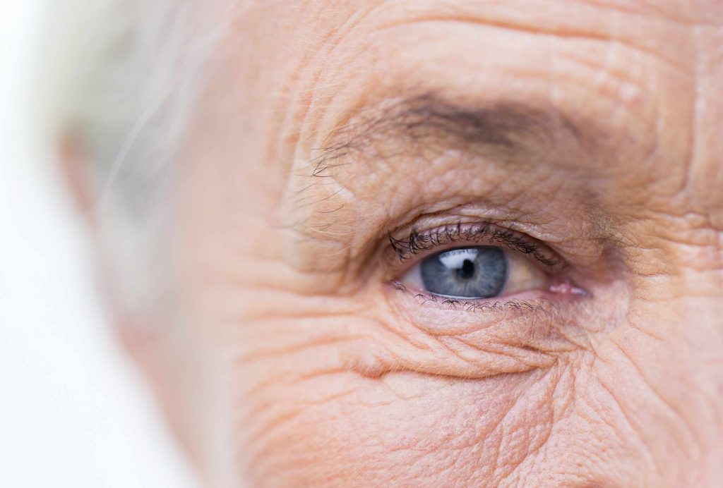 a close-up of an elderly woman's right eye