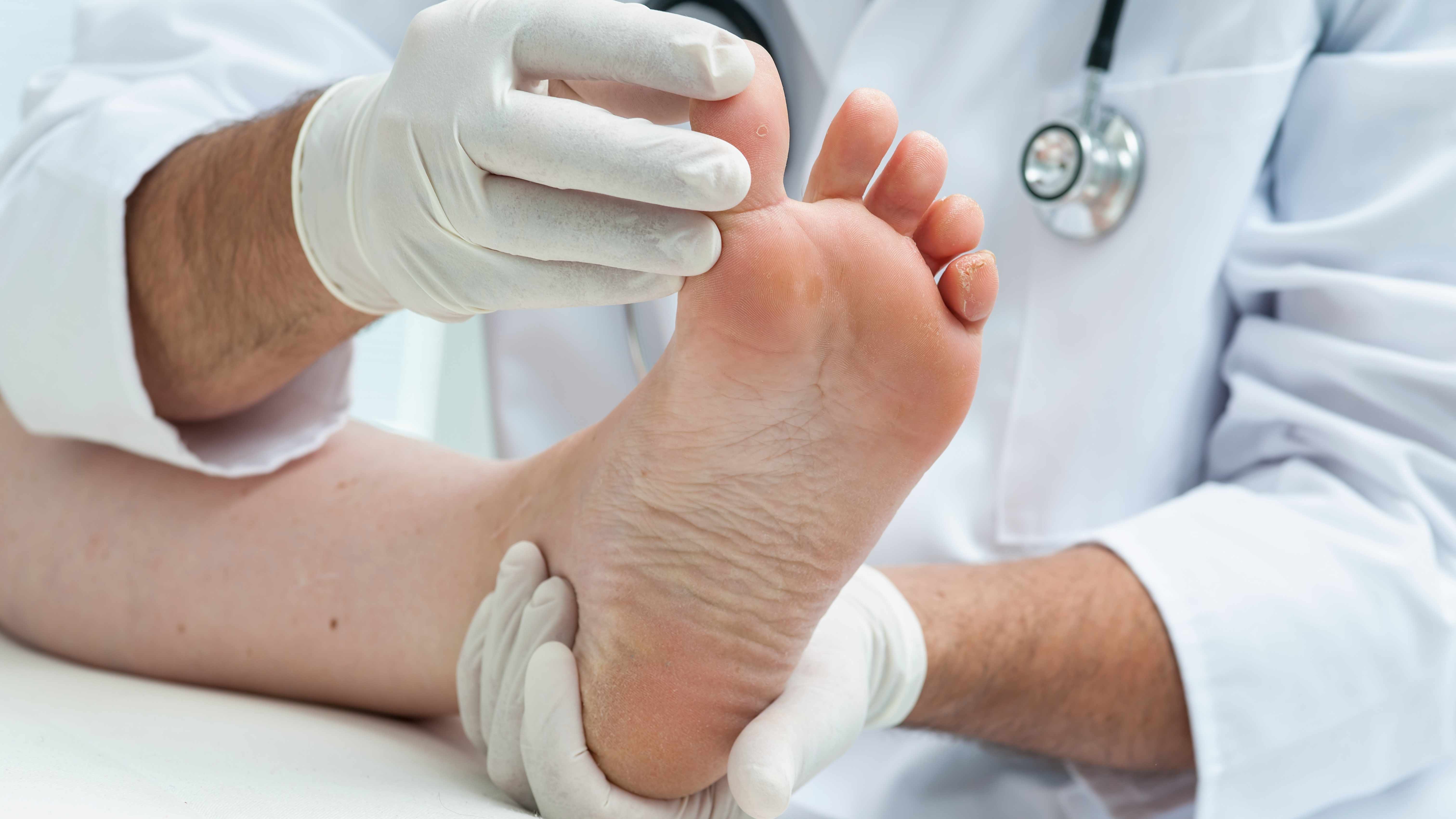 tandlæge efter skole Bebrejde Home Remedies: Fighting foot fungus - Mayo Clinic News Network
