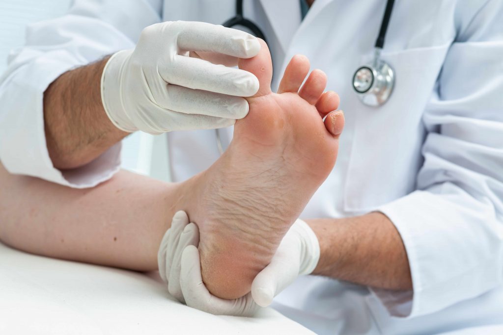 a medical person examining a person's foot for infection or athlete's foot