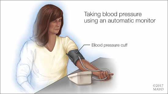 a medical illlustration of a woman checking her own blood pressure using an automatic monitor