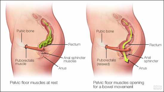 https://newsnetwork.mayoclinic.org/n7-mcnn/7bcc9724adf7b803/uploads/2017/02/normal-pelvic-floor-16x9.jpg