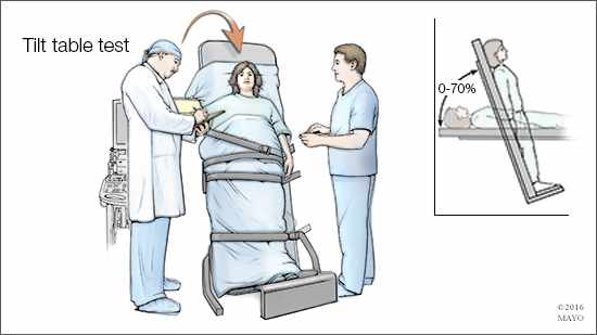 Ilustración médica del estudio con la mesa basculante para el diagnóstico de taquicardia postural ortostática.  