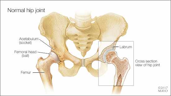 a medical illustration of normal hip joint anatomy