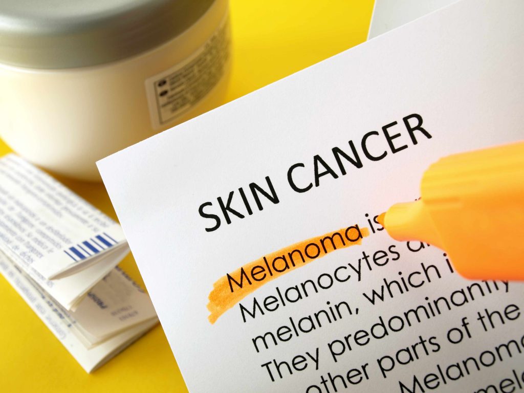 The word skin cancer with melanoma highlighted.