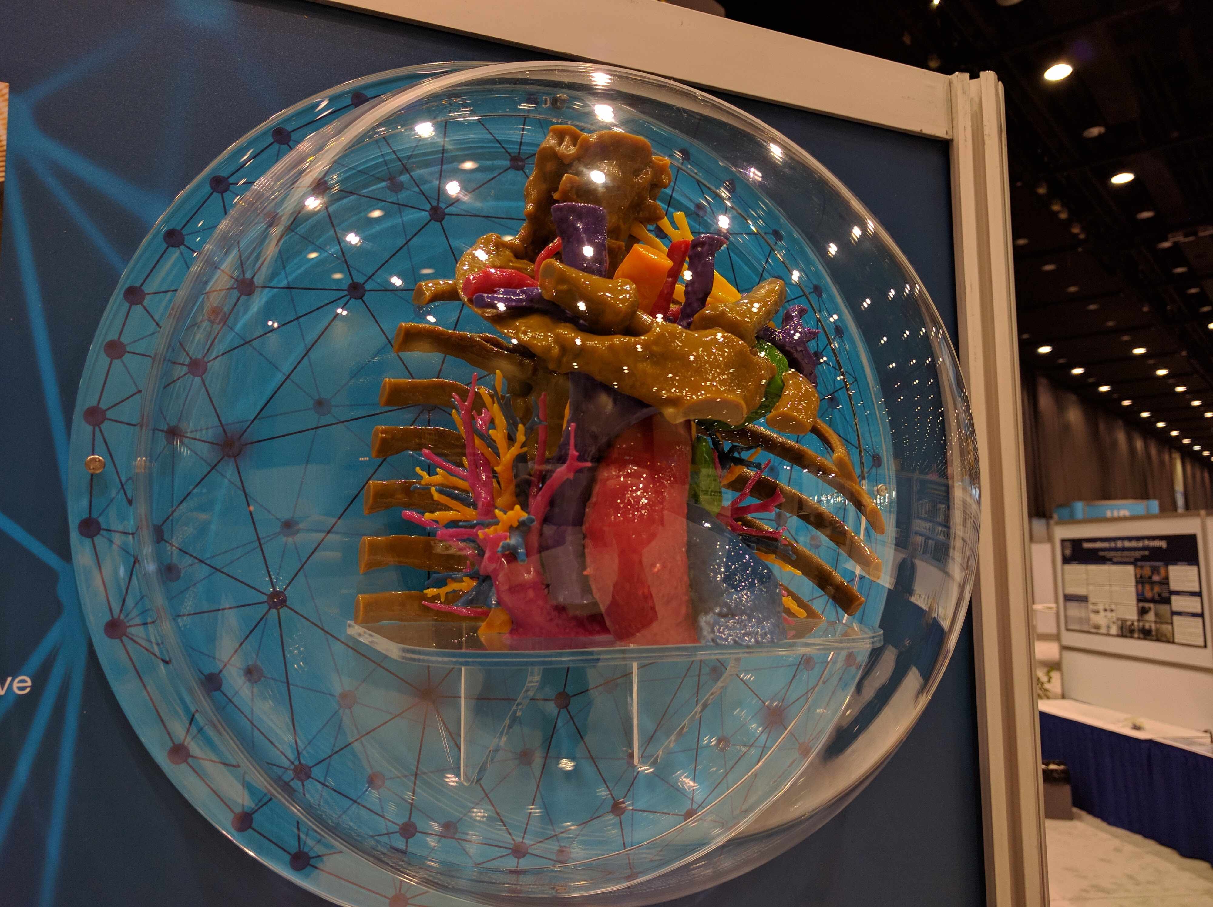 Picture of 3-D anatomic model