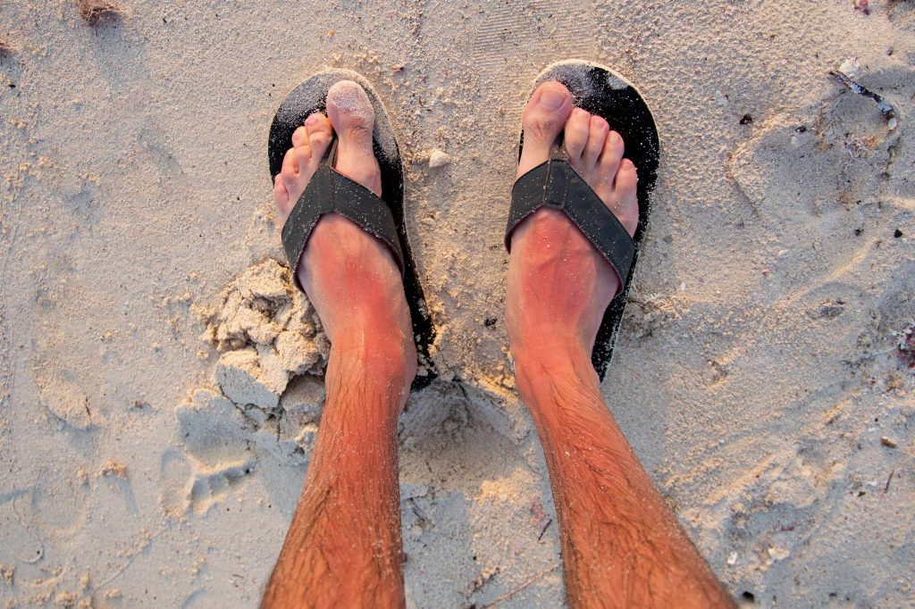 an overhead photo of a man's sunburned lower legs and feet in flip-flops, on the beach