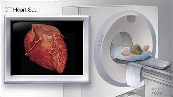 a medical illustration of a CT heart scan in progress