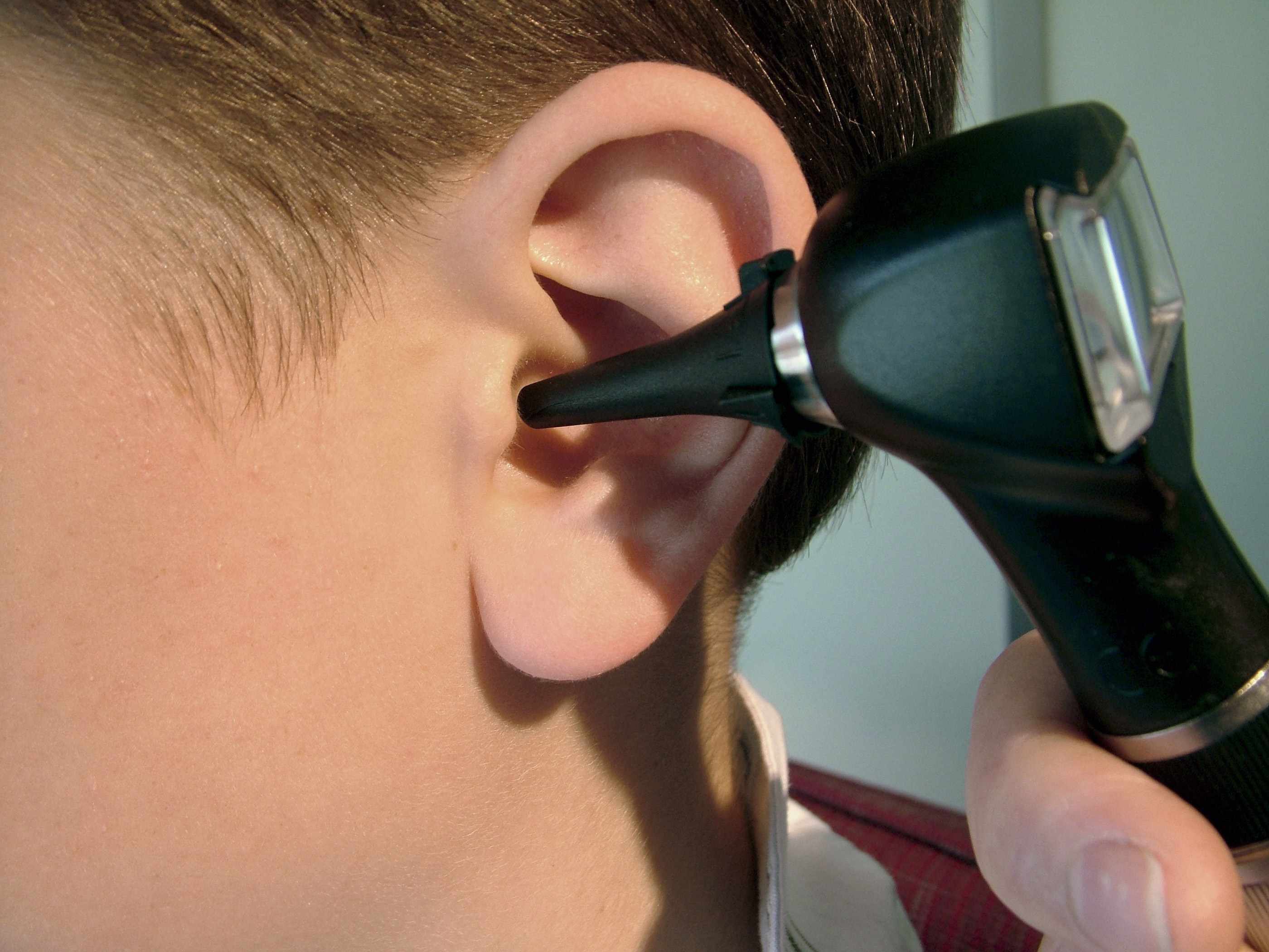 Воспаление уха чем лечить в домашних условиях