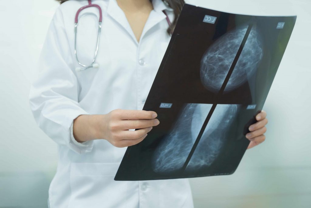 Mammogram film image in female doctor hands