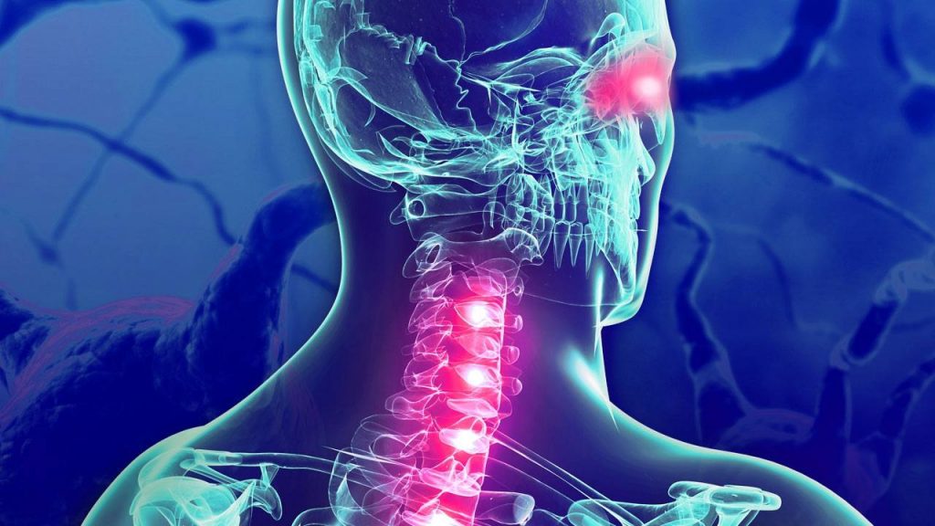 Imagen tridimensional de la médula espinal y el cuello