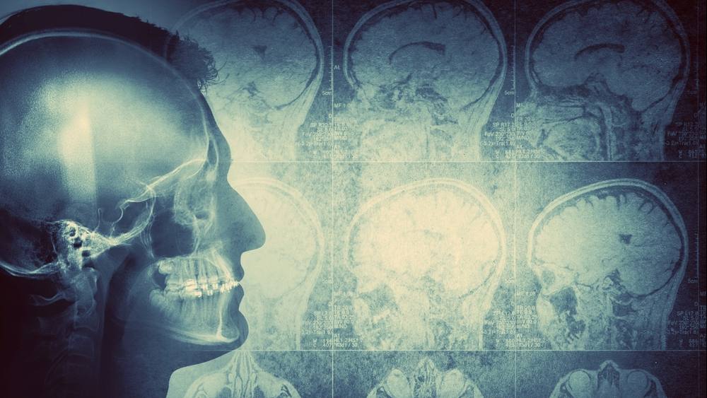 Imagen conceptual de un hombre visto de perfil que muestra el cerebro y la actividad cerebral