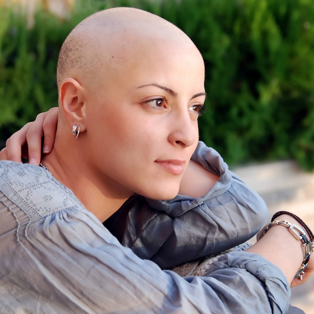 a close-up of a young woman who has lost her hair due to cancer treatment