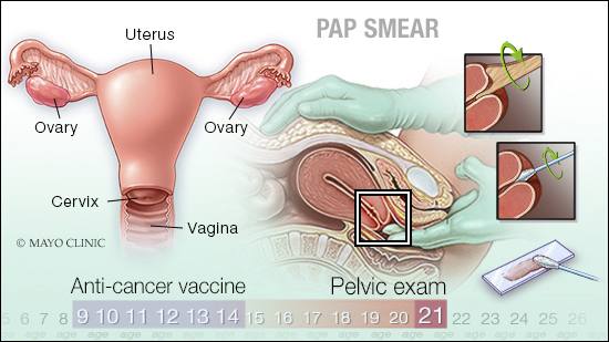 a medical illlustration of a Pap smear examination, the female reproductive organs, and the timeline of ages for anti-cancer vaccines and pelvic exams