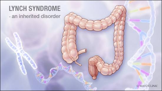 a medical illustration of Lynch syndrome